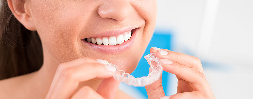 Braces & Aligners – Stafford Smiles